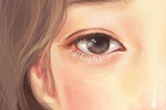 嘉兴埋线双眼皮的优点